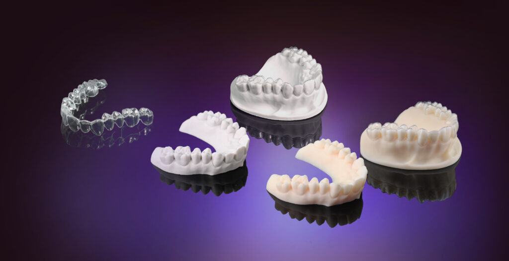 Printed Teeth Molds in Keystone Materials