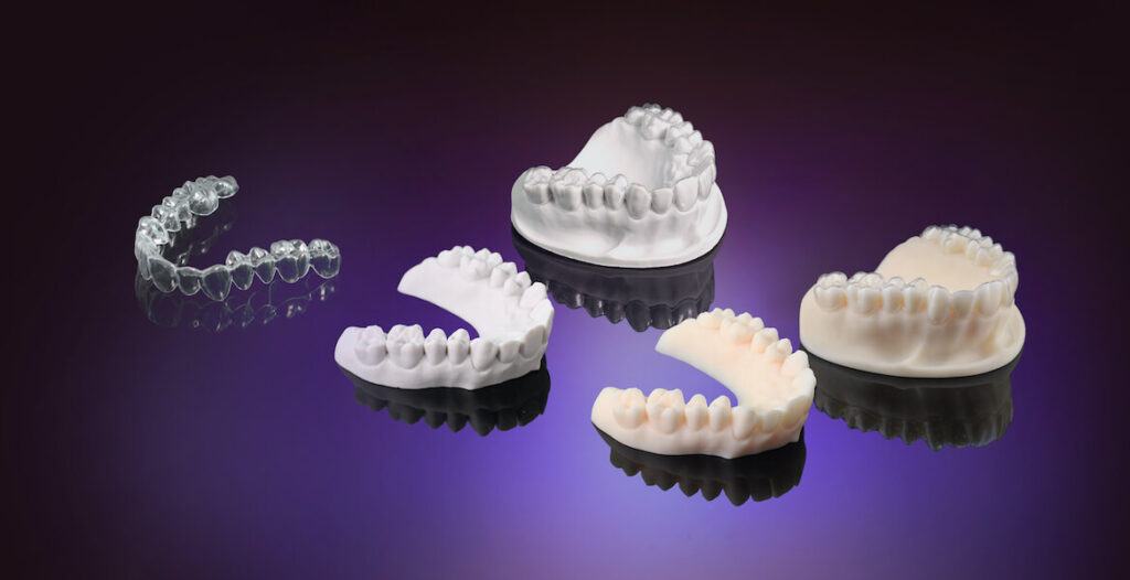 3D printed molds of teeth