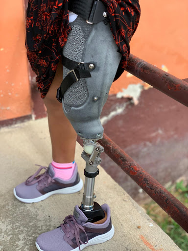 prosthetic leg custom production example 